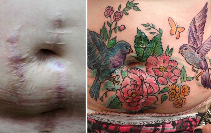 Mastectomy Abuse Scar Women Free Tattoo Flavia Carvalho Daedra Art Brasil 5
