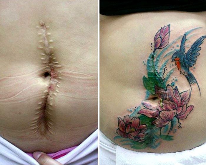 Mastectomy Abuse Scar Women Free Tattoo Flavia Carvalho Daedra Art Brasil 6
