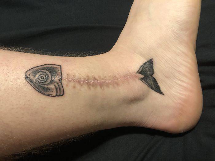 33 fois où des gens ont voulu cacher des cicatrices et des taches de naissance et les tatoueurs ont assuré